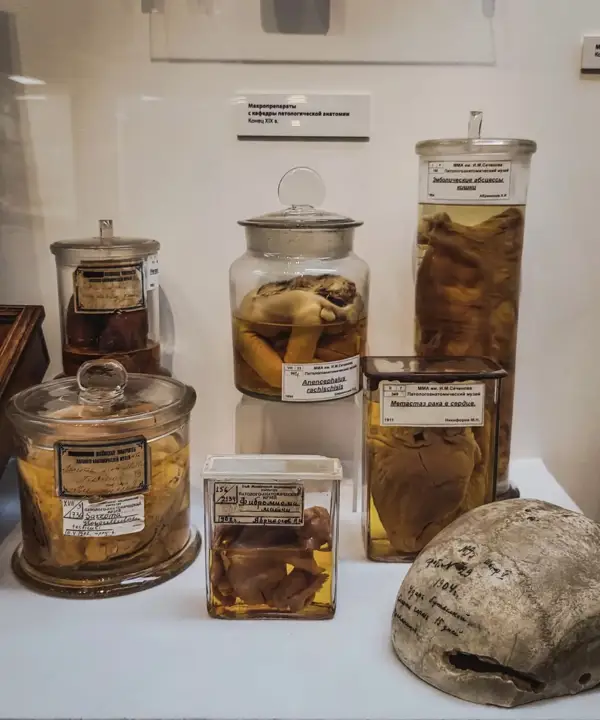 Анатомические препараты в музее истории медицины